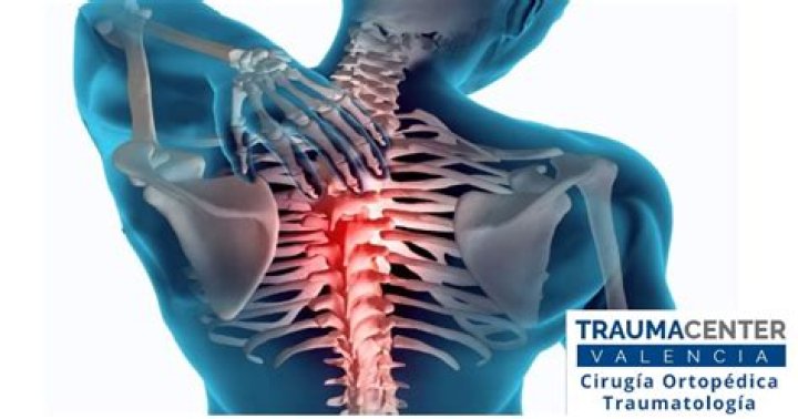 Estrés y dolor de espalda